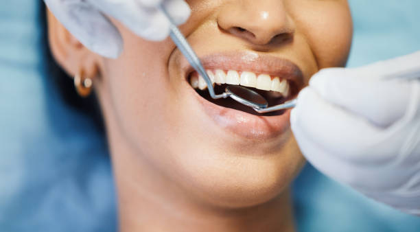 Best Chipped Tooth Repair Near Me  in Flanders, NY